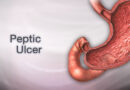 Doctors may soon diagnose peptic ulcer & disease stage by recognising breath patterns