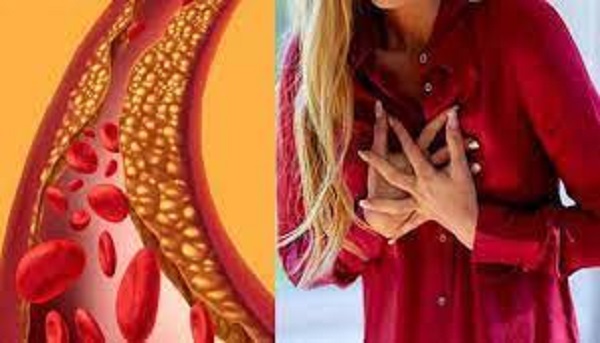 इन लोगों में बढ़ सकता है Bad Cholesterol का खतरा, दिल की बीमारियों से बचने के लिए रहें सतर्क